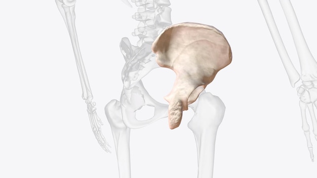 Photo the hip bone is comprised of the three parts the ilium pubis and ischium