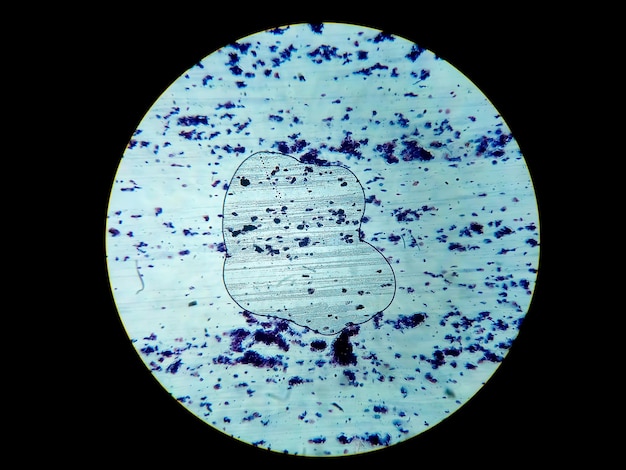 Histologische dia van een weefselmonster onder microscopie