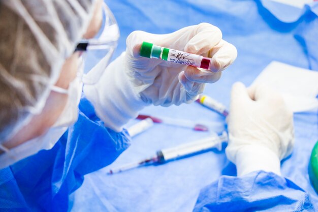 Hiv and aids infection test, doctors face and hand holding tube with blood on the blue table. .