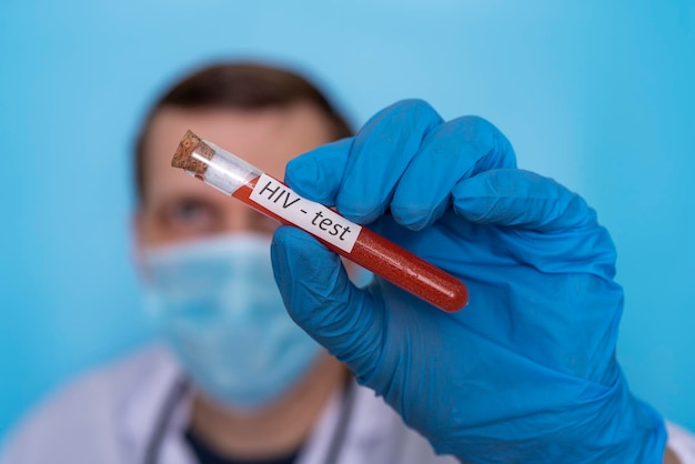 Hiv test the doctor's hand holds a test tube in medical gloves