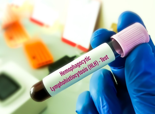 Hlh or hemophagocytic lymphohistiocytosis, a disease where\
white blood cells damage organs