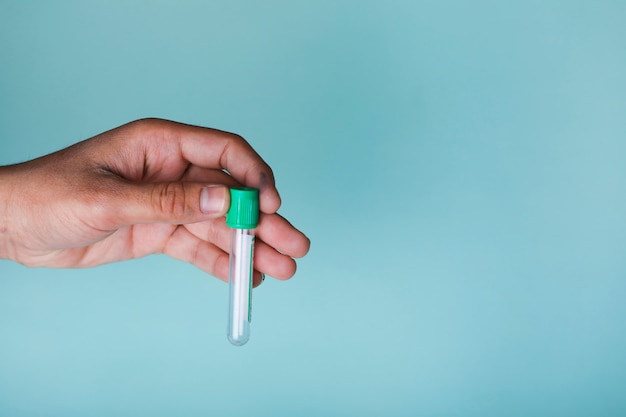 holding blood sample tube in hand