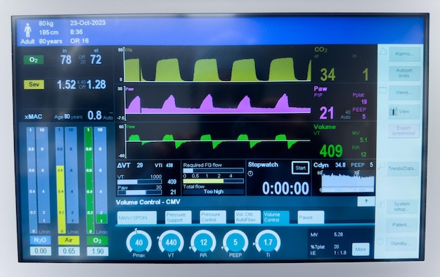 Foto monitor ospedaliero che mostra i segni vitali pressione sanguigna frequenza cardiaca ossimetria del polso e temperatura