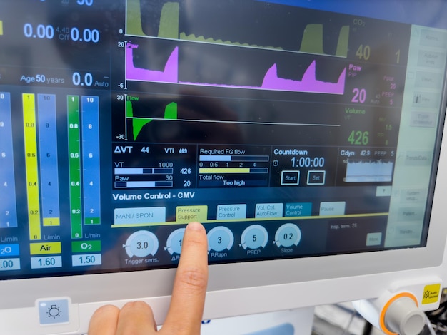 Foto monitor ospedaliero che mostra segni vitali frequenza cardiaca pressione sanguigna ossigenazione e co2 endtidale