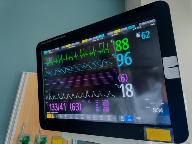 Hospital monitor displays vital signs heart rate blood pressure EKG and oxygen levels symbolizi