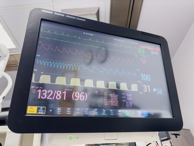 Hospital monitor symbolizes vital signs heart rate blood pressure oxygen levels temperature ens