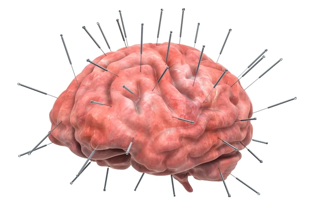 침술 바늘이 있는 인간의 뇌 침술 치료 개념 3D 렌더링
