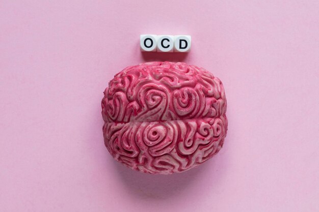 Человеческий мозг со словом OCD Концепция психического здоровья