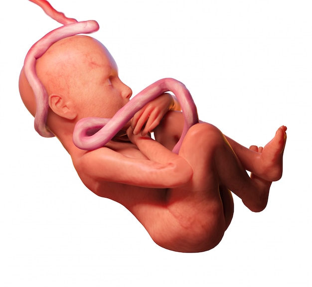 human fetus with umbilical cord around the neck, isolated on white background
