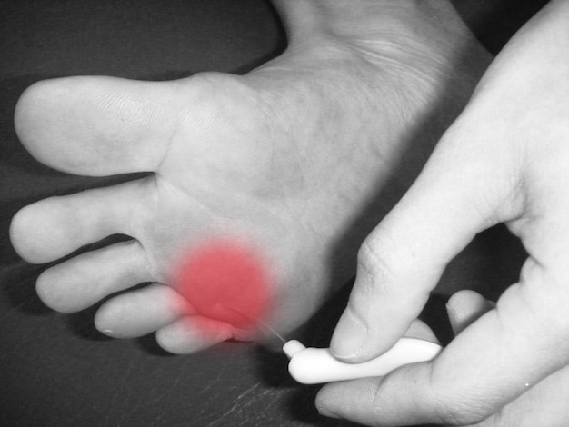 human foot injury Focus on a single color on the feet