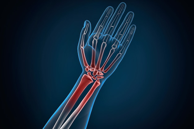 Photo human hand and wrist pain caused by arthritis