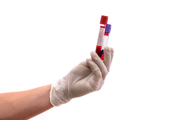 白で隔離の赤い試験管を持つ人間の手。医療の概念