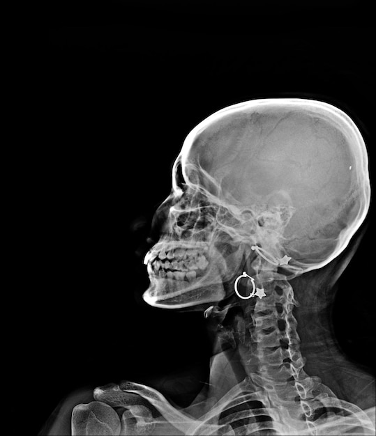 A human head with a hoop earring in it.