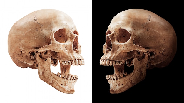 分離された人間の頭蓋骨