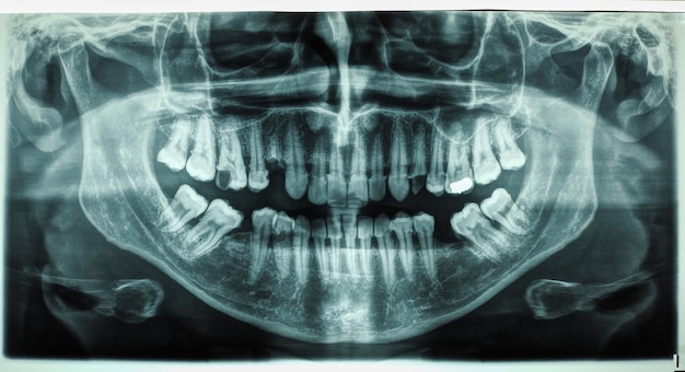 Human teeth xray