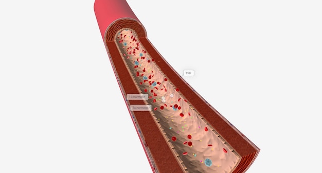 写真 甲状腺機能亢進症 血流中の甲状腺ホルモンレベル