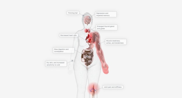 Photo hypothyroidism may not cause noticeable symptoms at first