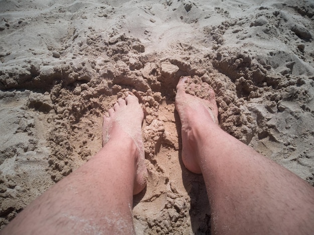 Image of burned legs on the beach sand aftermath of summer