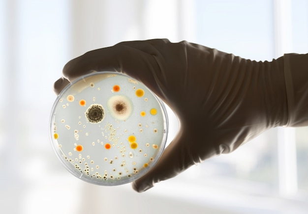 An image of a hand holding a petri dish