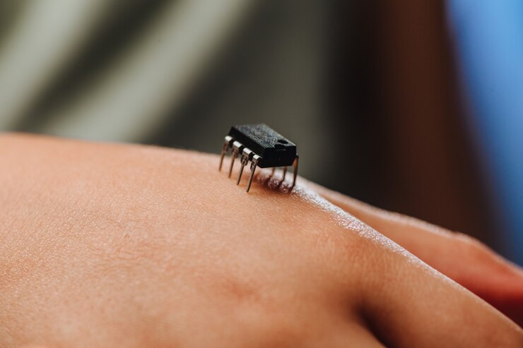 Photo implantation of a small black chip in hand