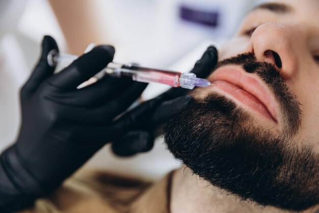 Increased lip size for men Injection of hyaluronic acid into the lips of a young stylish bearded man