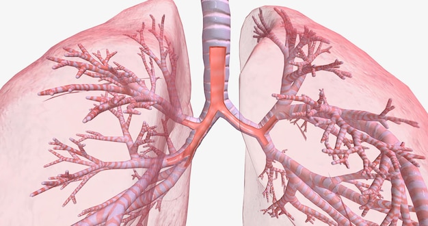 Photo inflammation and constriction of airways