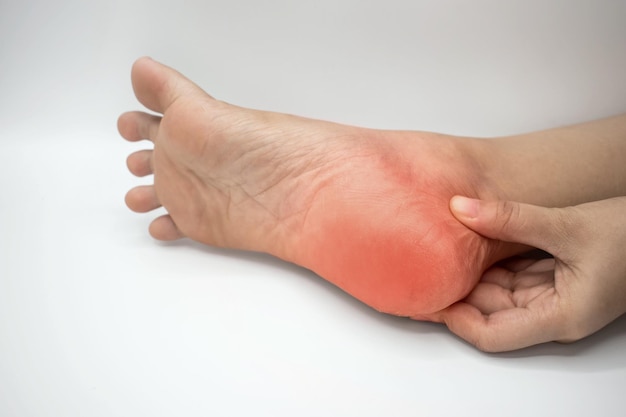 Photo inflammation at heel concept of foot pain