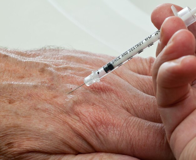 Injection into hand of senior male