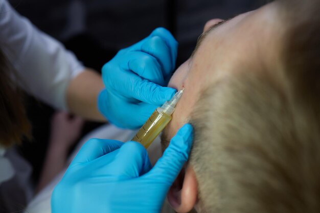 Инъекция в спа-салоне врач руки в перчатках крупным планом красивый пациент мужского пола косметические процедуры здоровый