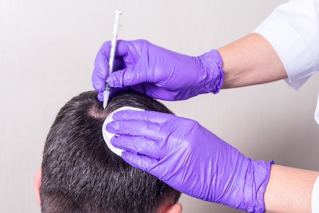 Photo injection, treatment for hair loss