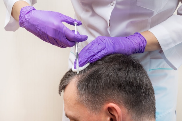 Injection, Treatment for Hair Loss