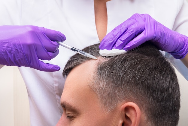 Injection, Treatment for Hair Loss