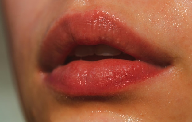 Injections plastic surgery collagen and beauty treatments lip
balm lipcare lipstick closeup of sexy