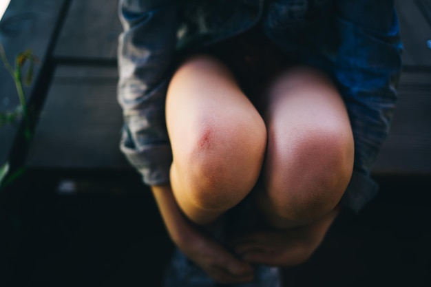 injured knee of a child sitting on the floor