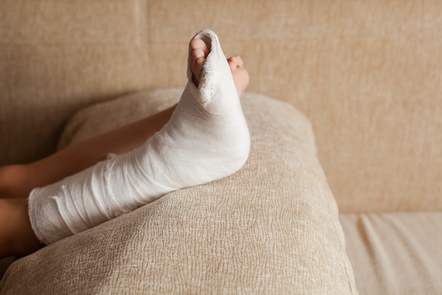 Injured leg of an unrecognizable girl in a cast lying on the sofa at home