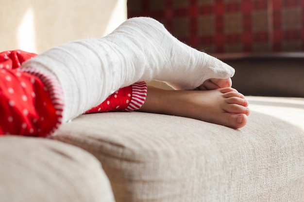 Injured leg of an unrecognizable girl in a cast lying on the\
sofa at home