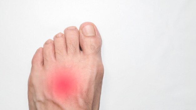 Instep of a person left foot with a red mark representing pain with space on the right for text