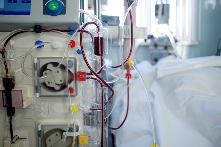 Foto intensieve zorg spoedafdeling met hemodialysemachine (of hemofiltratieprocedure), patiënt in kritieke houding