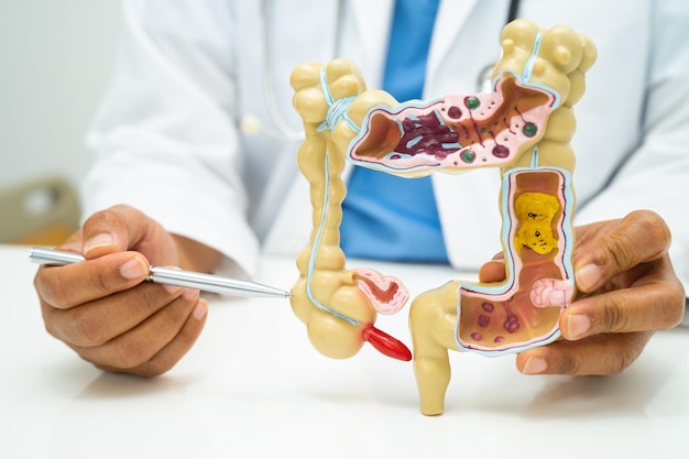 Foto dottore dell'appendice intestinale e del sistema digestivo con modello di anatomia per lo studio, la diagnosi e il trattamento in ospedale