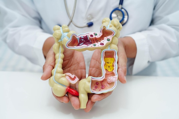 intestine doctor holding human anatomy model for study diagnosis and treatment in hospital