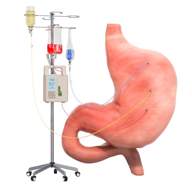Intraveneus therapie systeem met menselijke maag Behandeling en geneesmiddelen voor maagziekten concept 3D-rendering