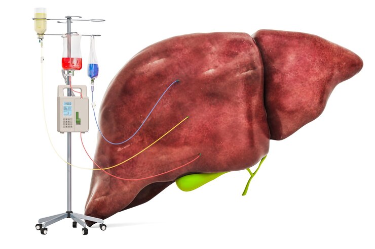 Intravenous therapy system with human liver Treatment of liver diseases concept 3D rendering
