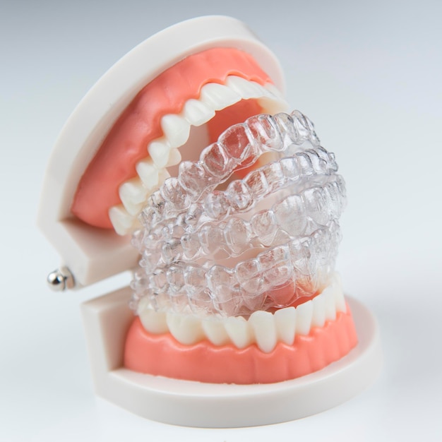 Invisible and removable aligners for teeth alignment