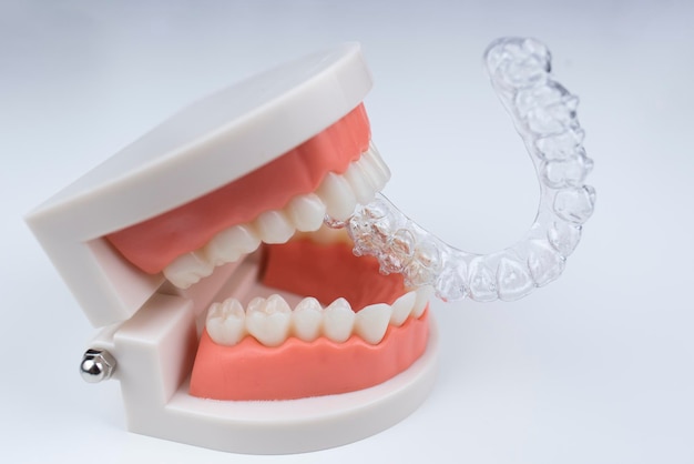 Photo invisible and removable aligners for teeth alignment