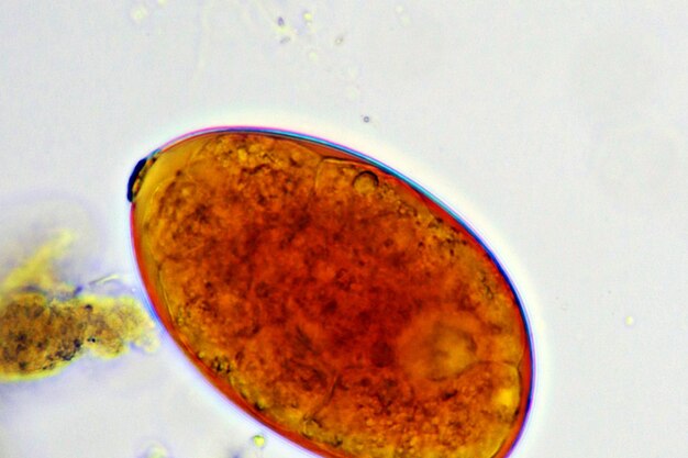 Inzicht in het voorkomen en behandelen van trichinellose-infecties.