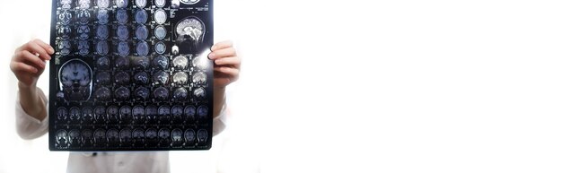 Isolated poster with doctor holding a picture of a brain MRI workflow in diagnostic hospital