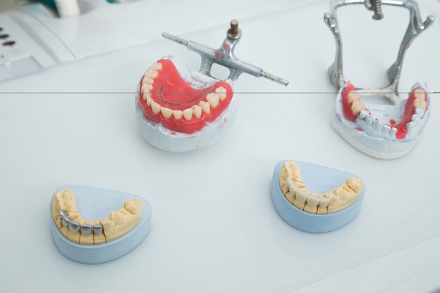 Jaw mock-up on the dentist's table