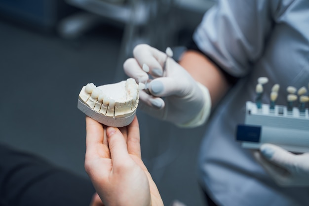 Jaw teeth model in the hands of a patient in the stomatology clinic. Female dentist shows the suitable color of a tooth on an artificial jaw. Close-up.