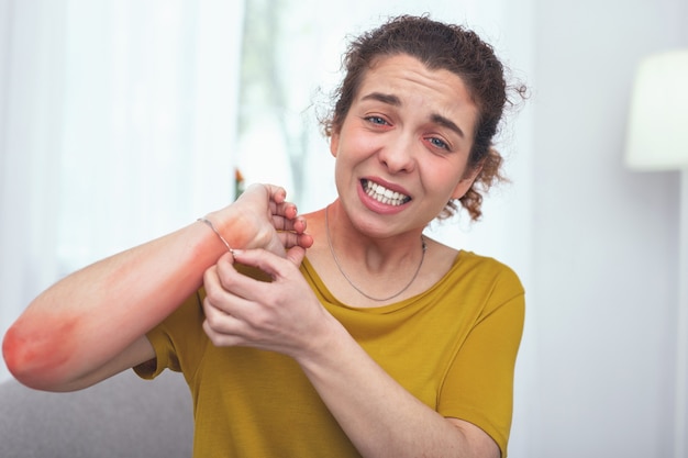 Jeukende arm. Jonge, ziek uitziende dame die zich ongeduldig voelt en gretig is om een armband af te doen, wat haar allergische reactie veroorzaakt in de vorm van uitslag op haar arm