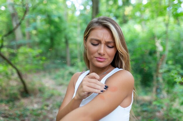 Jeukende insectenbeet Geïrriteerde jonge vrouw die in de zomer aan haar jeukende arm krabt van een muggenbeet in het park